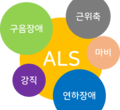 신경퇴화질환 - 근위축성측삭경화증